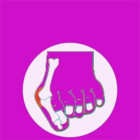 Bütyök barát - kímélő lábbelik