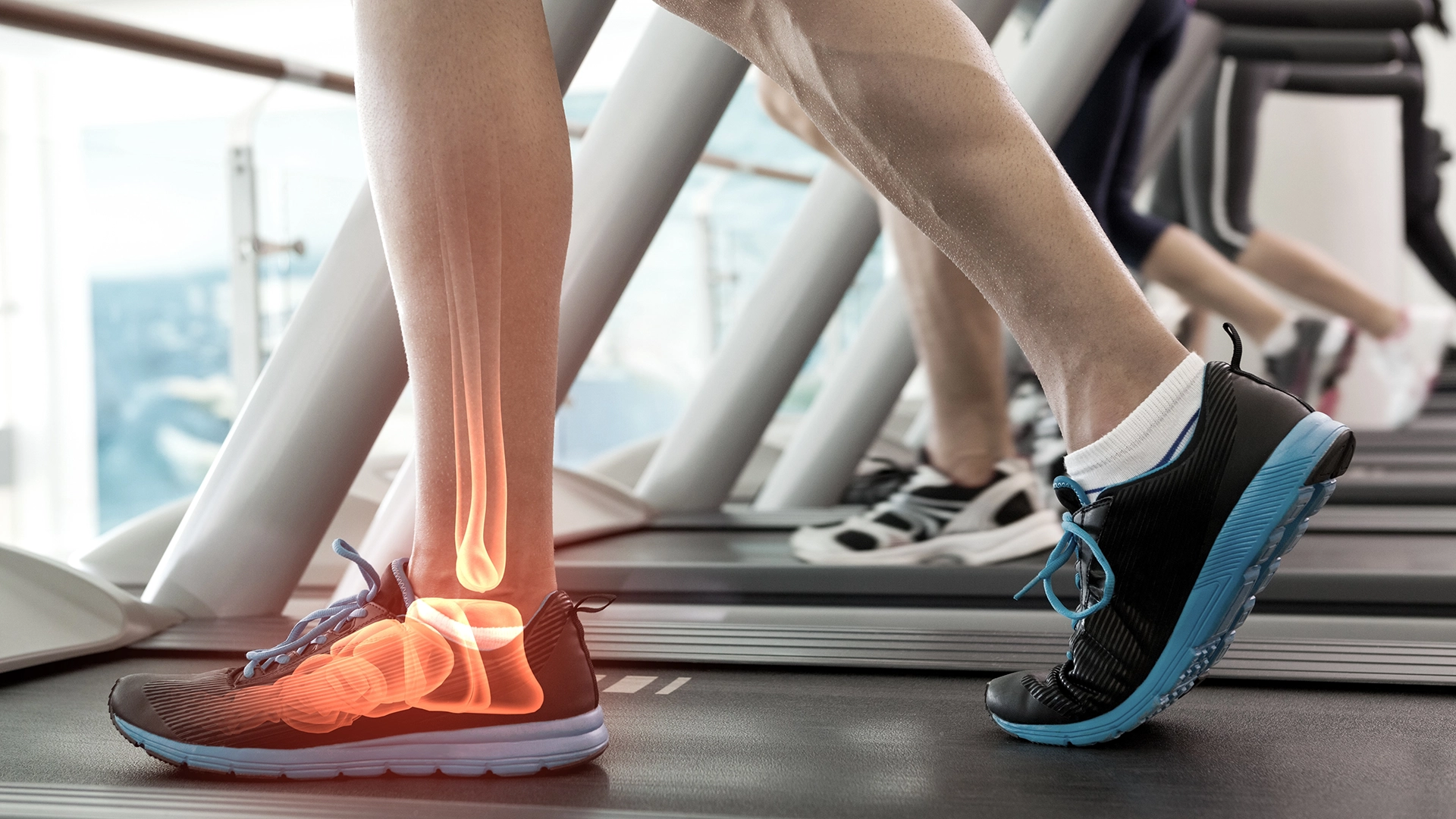 Aktív tavasz – Figyelj a mozgásszervi egészségre! 