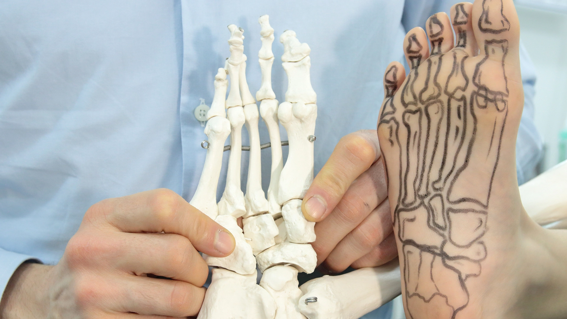 A vékony talpú lábbelik hátulütői 